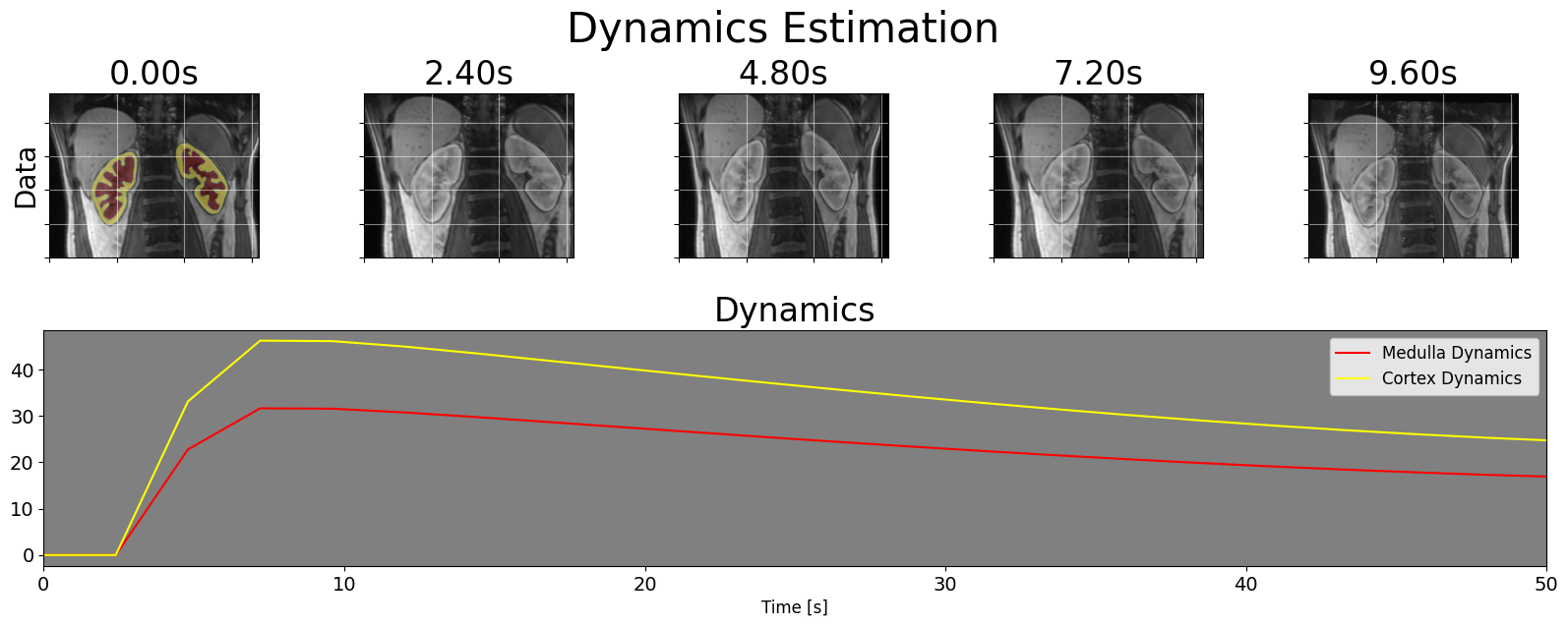 Kidney MRI Images with Movement and Dynamics